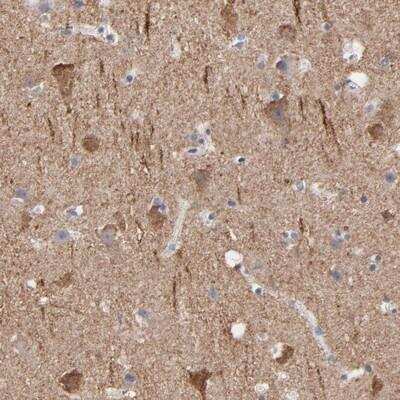 Immunohistochemistry-Paraffin: Contactin-3 Antibody [NBP1-89971]