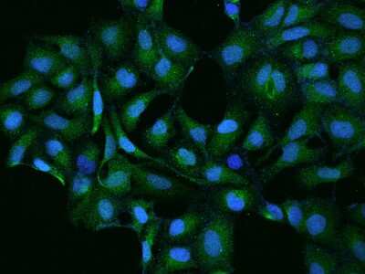 Immunocytochemistry/ Immunofluorescence: Contactin-5 Antibody [NBP2-97316]