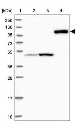 Western Blot: Contactin-5 Antibody [NBP1-83242]