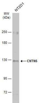 Western Blot: Contactin-5 Antibody [NBP2-15933]