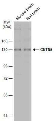 Western Blot: Contactin-5 Antibody [NBP2-15933]