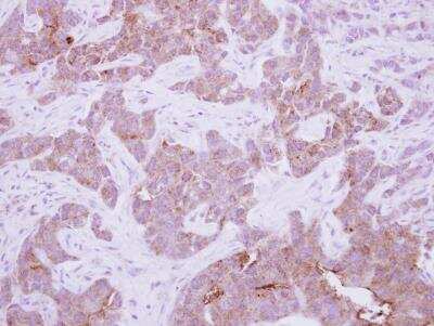 Immunohistochemistry-Paraffin: Copine-6 Antibody [NBP2-15960]