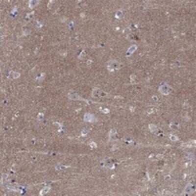 Immunohistochemistry-Paraffin: Copine-6 Antibody [NBP3-17234]