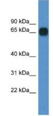 Western Blot: Copine-6 Antibody [NBP1-79763]