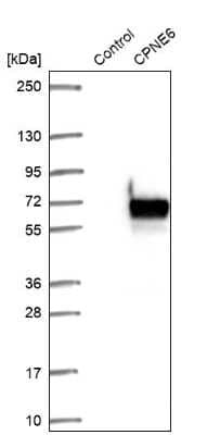 Western Blot: Copine-6 Antibody [NBP1-87521]