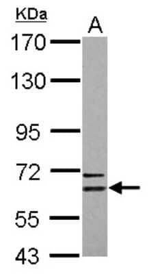 Western Blot: Copine-6 Antibody [NBP2-15960]