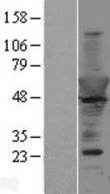 Western Blot: Copine-6 Overexpression Lysate [NBP2-04307]