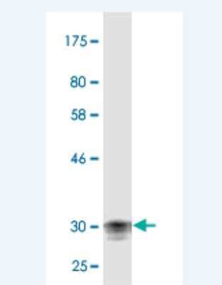 Western Blot: Corneodesmosin Antibody (5B4) [H00001041-M02]