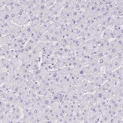 Immunohistochemistry-Paraffin: Corneodesmosin Antibody [NBP2-37942]