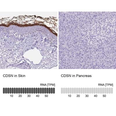 Immunohistochemistry-Paraffin: Corneodesmosin Antibody [NBP2-47501]