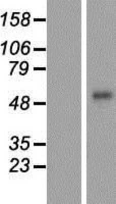 Western Blot: Corneodesmosin Overexpression Lysate [NBP2-10968]