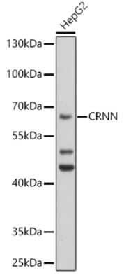 Western Blot: Cornulin AntibodyBSA Free [NBP2-92568]