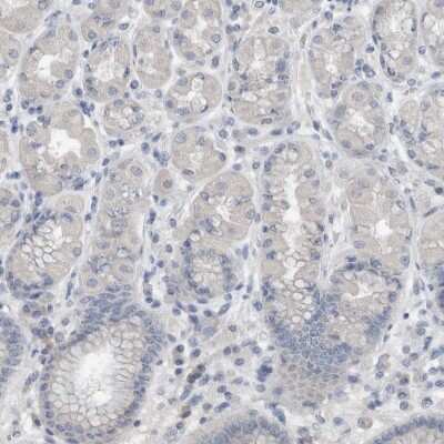 Immunohistochemistry-Paraffin: Cornulin Antibody [NBP1-88479]