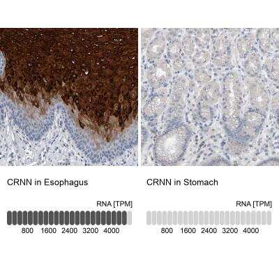 Immunohistochemistry-Paraffin: Cornulin Antibody [NBP1-88479]