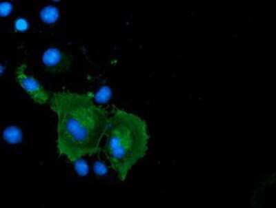 Immunocytochemistry/ Immunofluorescence: Coronin-1a Antibody (OTI1A5) [NBP2-02779]