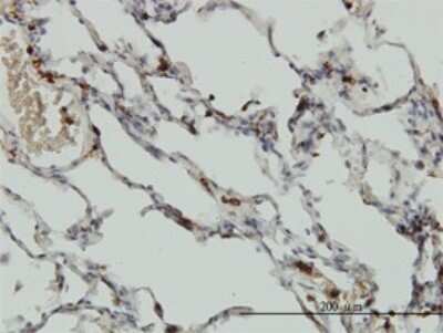 Immunohistochemistry-Paraffin: Coronin-1a Antibody (4G10) [H00011151-M01]