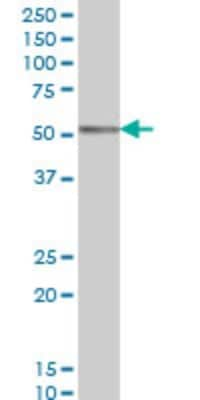 Western Blot: Coronin-1a Antibody (4G10) [H00011151-M01]