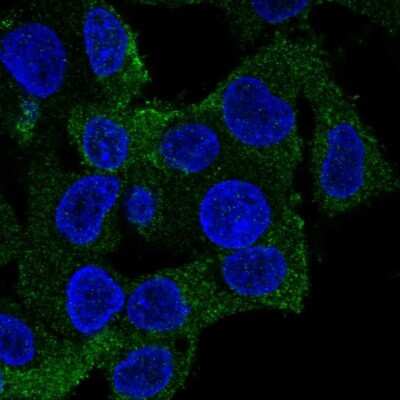 Immunocytochemistry/ Immunofluorescence: Coronin-1a Antibody [NBP2-13861]