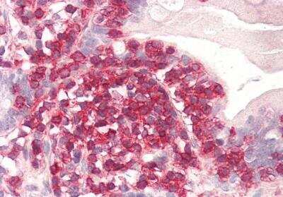 Immunohistochemistry-Paraffin: Coronin-1a Antibody [NB100-1298]