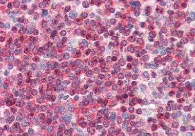 Immunohistochemistry-Paraffin: Coronin-1a Antibody [NB100-1298]