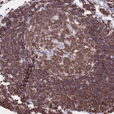 Immunohistochemistry-Paraffin: Coronin-1a Antibody [NBP2-13861]