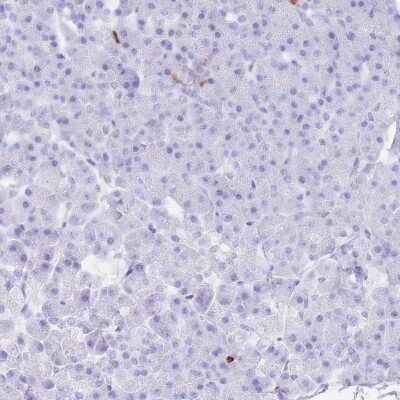 Immunohistochemistry-Paraffin: Coronin-1a Antibody [NBP2-13861]