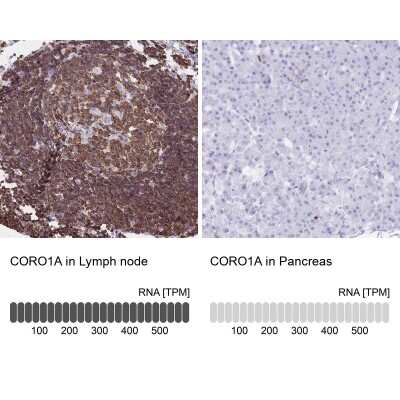 Immunohistochemistry-Paraffin: Coronin-1a Antibody [NBP2-13861]