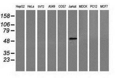 Western Blot: Coronin-1a Antibody (OTI1A5)Azide and BSA Free [NBP2-71680]