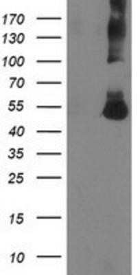 Western Blot: Coronin-1a Antibody (OTI1A5)Azide and BSA Free [NBP2-71680]