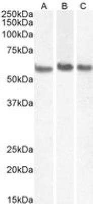 Western Blot: Coronin-1a Antibody [NB100-1298]