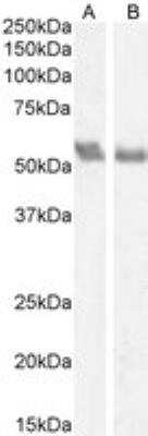 Western Blot: Coronin-1a Antibody [NB100-1298]