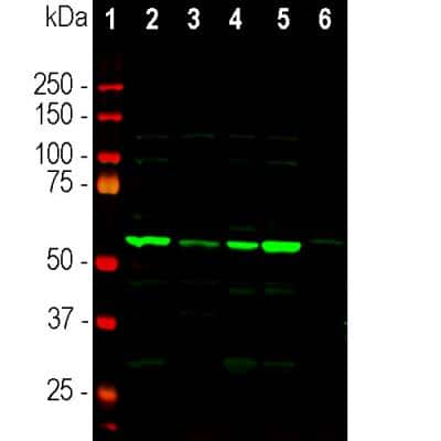 Western Blot: Coronin-1a Antibody [NB110-58867]