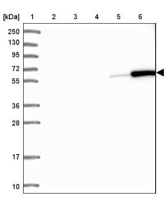 Western Blot: Coronin-1a Antibody [NBP2-13861]