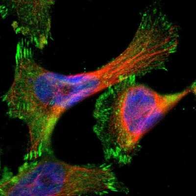 Immunocytochemistry/ Immunofluorescence: Coronin-2B Antibody [NBP1-85567]