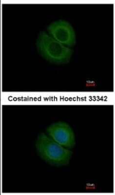 Immunocytochemistry/ Immunofluorescence: Coronin-2B Antibody [NBP2-15969]