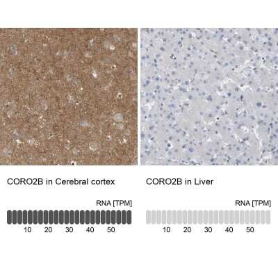 Immunohistochemistry-Paraffin: Coronin-2B Antibody [NBP1-85567]