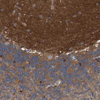 Immunohistochemistry-Paraffin: Coronin-2B Antibody [NBP1-85567]