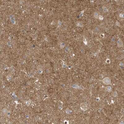 Immunohistochemistry-Paraffin: Coronin-2B Antibody [NBP1-85567]