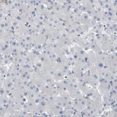 Immunohistochemistry-Paraffin: Coronin-2B Antibody [NBP1-85567]