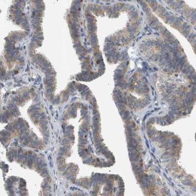 Immunohistochemistry-Paraffin: Coronin-2B Antibody [NBP1-85567]