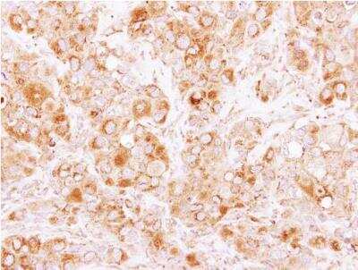 Immunohistochemistry-Paraffin: Coronin-2B Antibody [NBP2-15969]