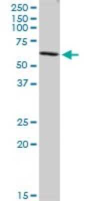 Western Blot: Coronin-2B Antibody [H00010391-B01P]