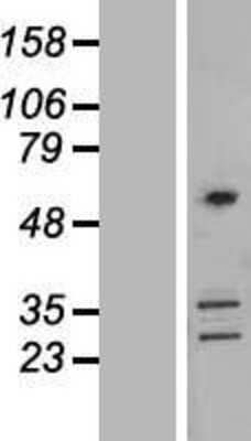 Western Blot: Coronin-2B Overexpression Lysate [NBL1-09401]