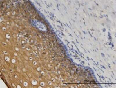 Immunohistochemistry-Paraffin: Coronin 3 Antibody (1F7) [H00023603-M02]
