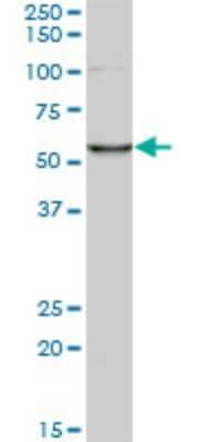 Western Blot: Coronin 3 Antibody (1F7) [H00023603-M02]