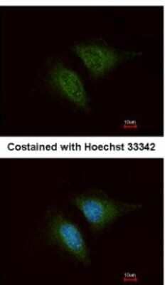 Immunocytochemistry/ Immunofluorescence: Coronin 3 Antibody [NBP1-31283]