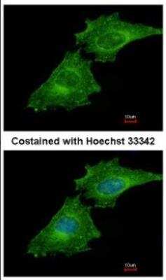 Immunocytochemistry/ Immunofluorescence: Coronin 3 Antibody [NBP2-15968]