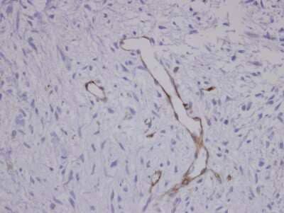 Immunohistochemistry-Paraffin: Coronin 3 Antibody [NBP1-31283]
