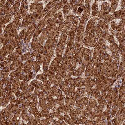 Immunohistochemistry-Paraffin: Coronin 3 Antibody [NBP1-85506]