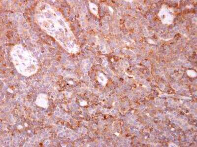 Immunohistochemistry-Paraffin: Coronin 3 Antibody [NBP2-15968]